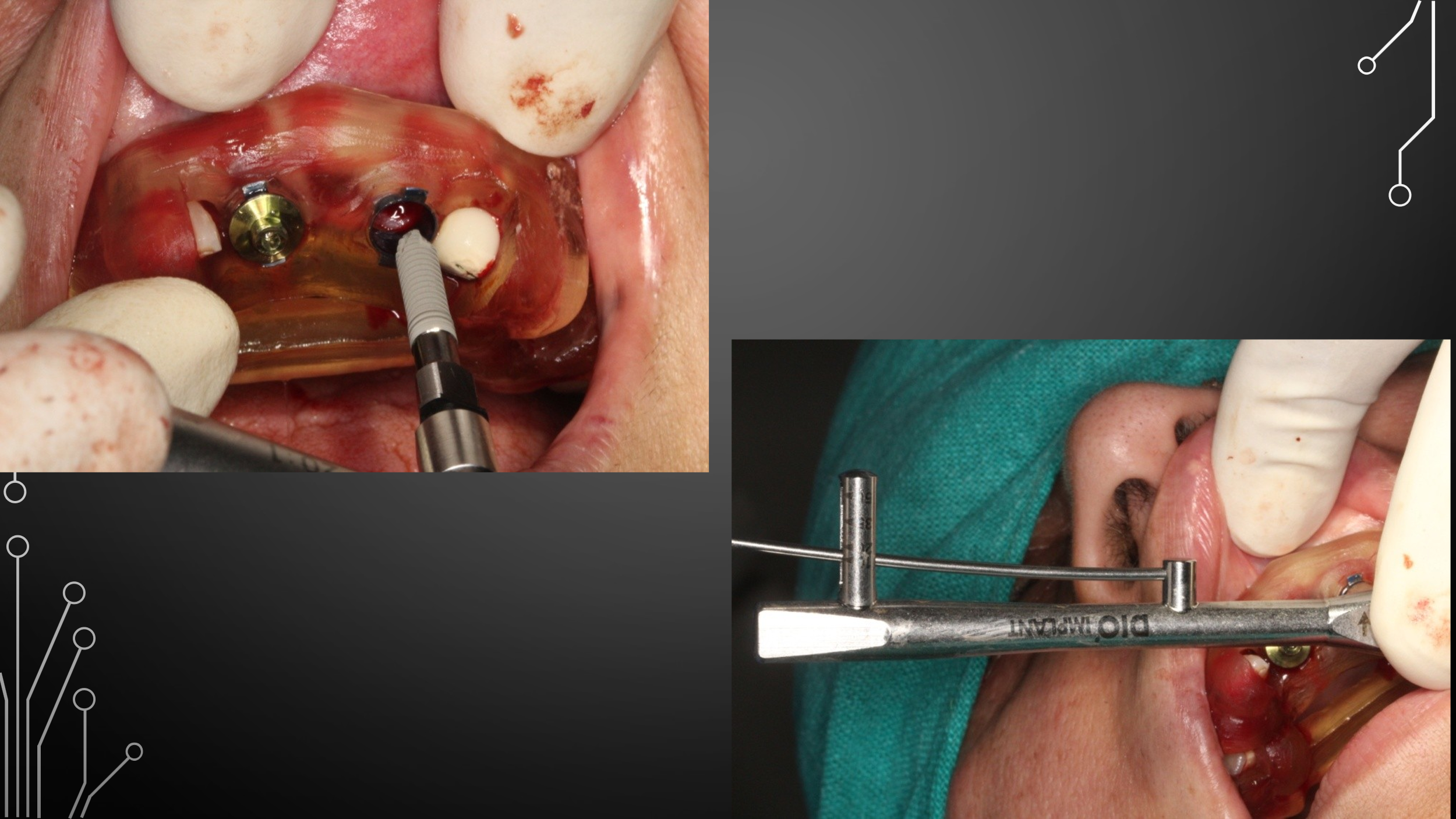Dental Treatment