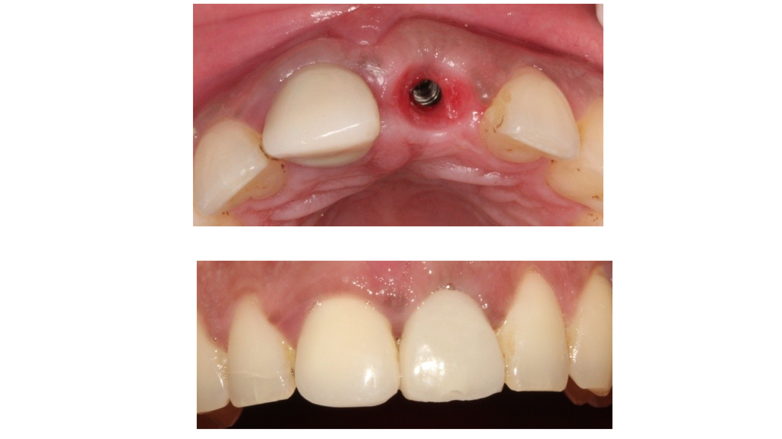 Dental Treatment