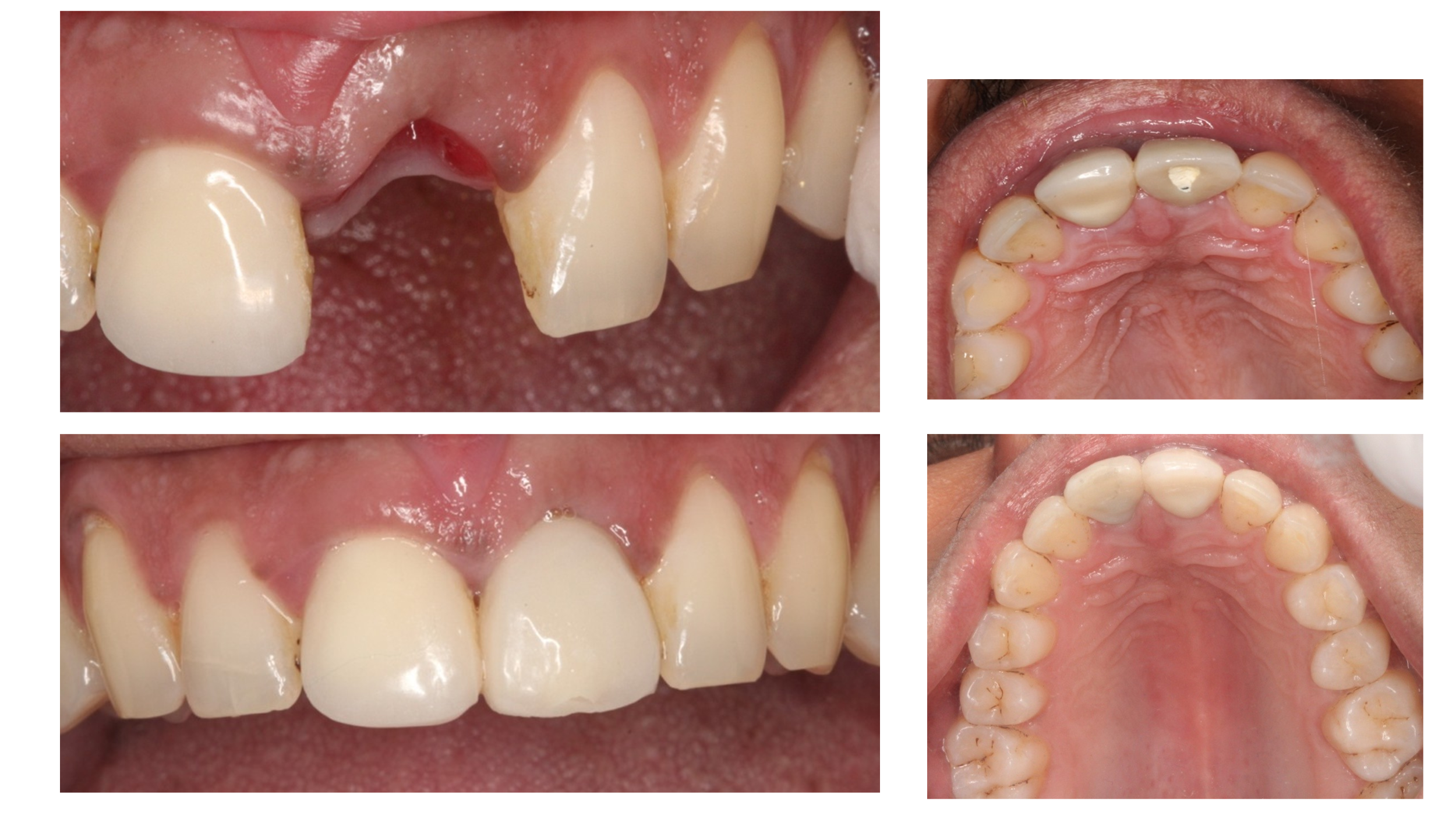 Dental Treatment