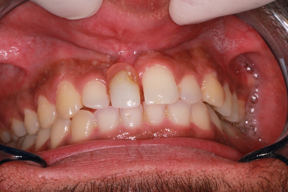 Dental Treatment