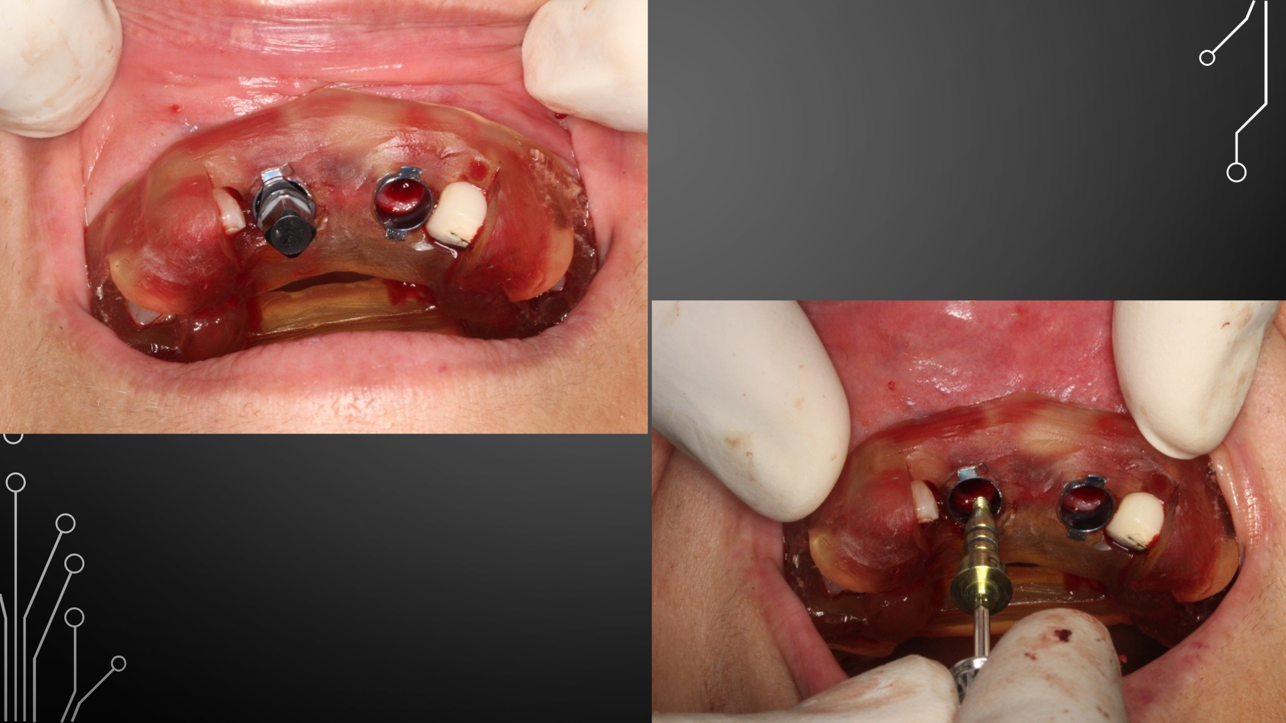Dental Treatment