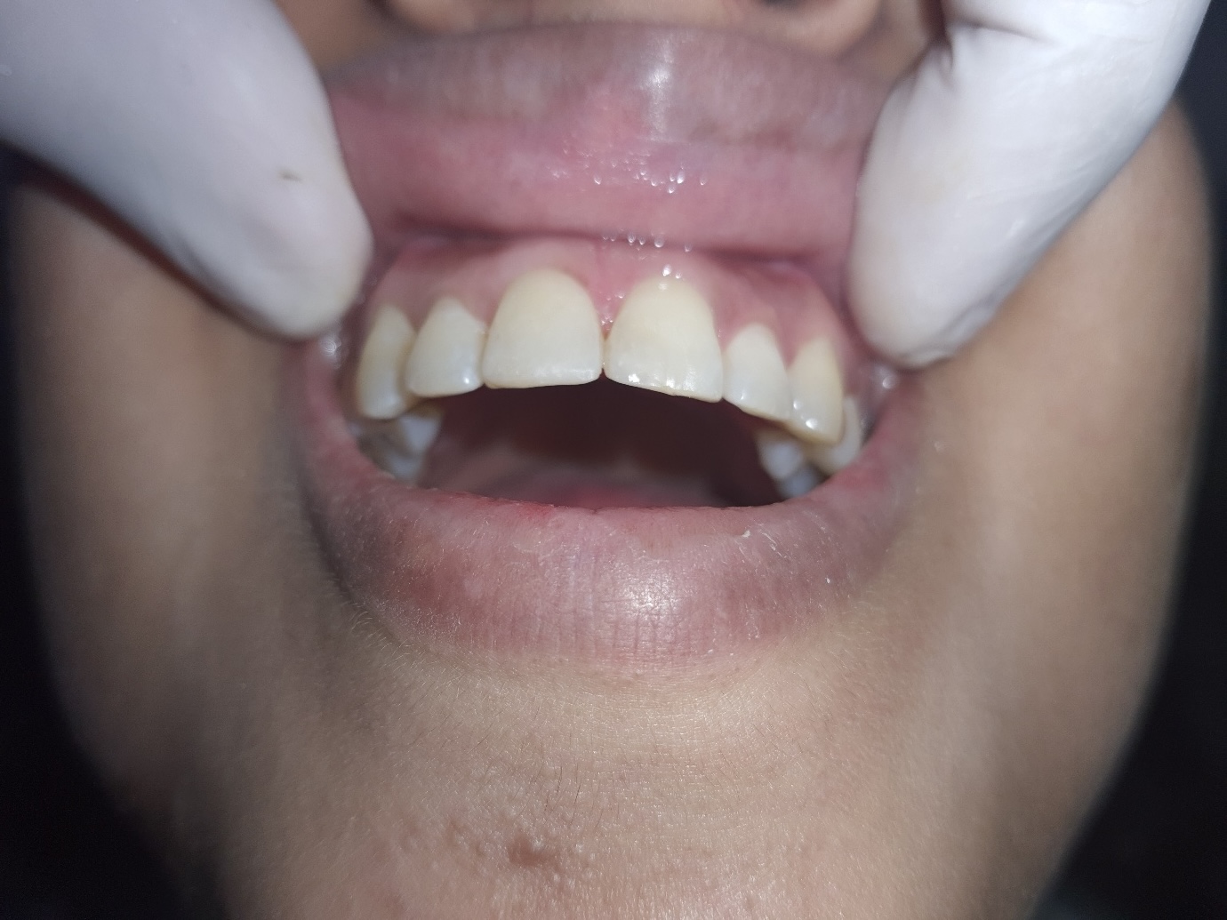 Dental Treatment