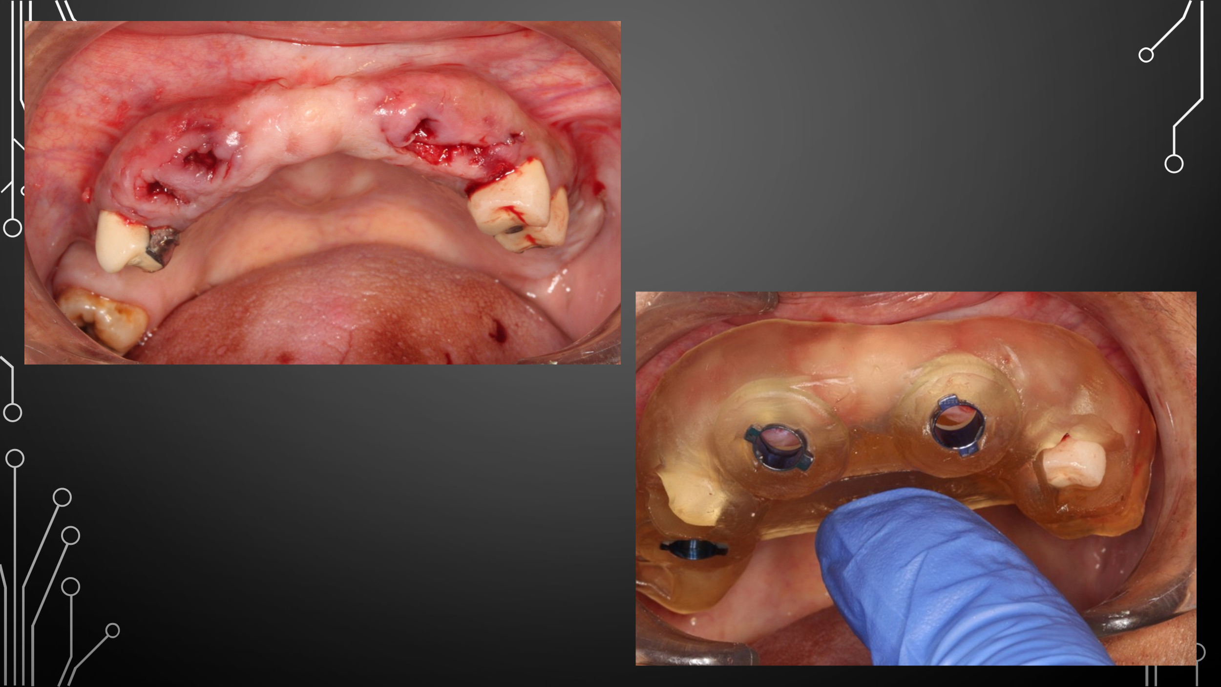 Dental Treatment