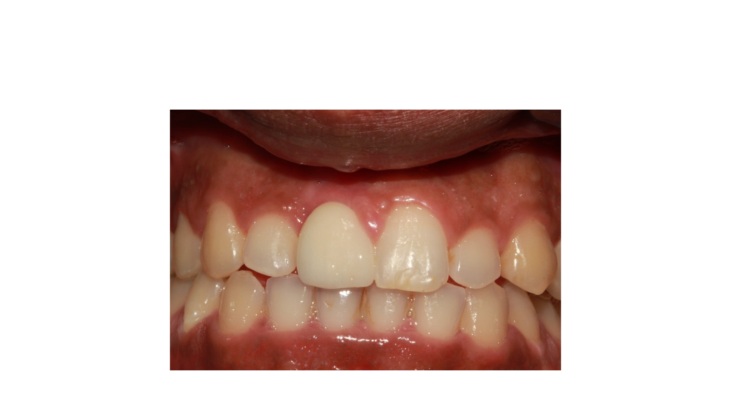 Dental Treatment