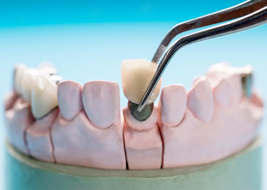 Prosthodontics